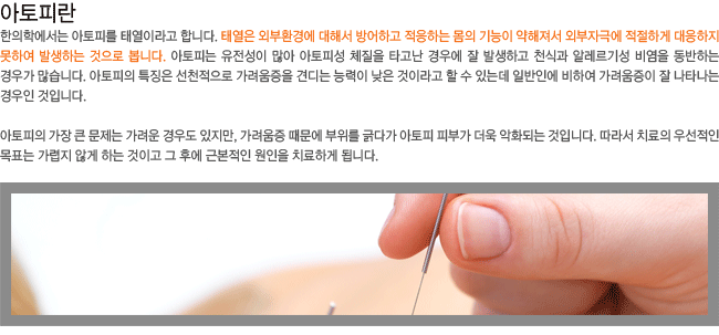 �����Ƕ�?-�¿��� �ܺ�ȯ�濡 ���ؼ� ����ϰ� �����ϴ� ���� ����� �������� �ܺ��ڱؿ� �����ϰ� �������� ���Ͽ� �߻��ϴ� ������ ���ϴ�.